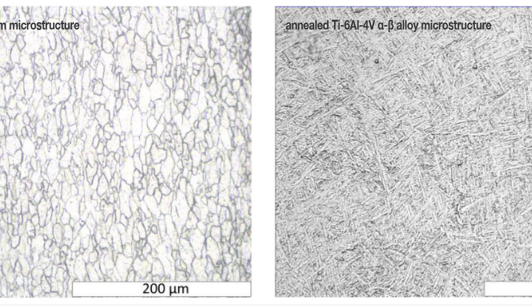 Microstructure of Titanium Alloys and Their Role in Biomedical Applications