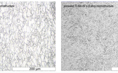 Microstructure of Titanium Alloys and Their Role in Biomedical Applications
